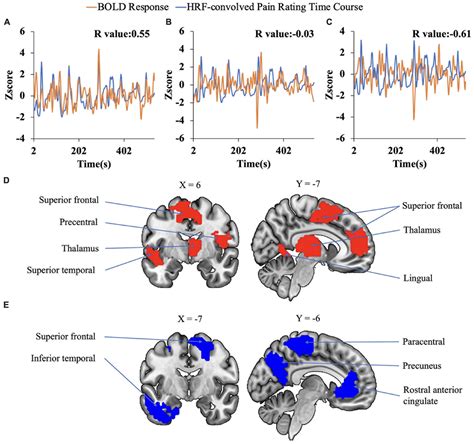 Imaging The Neural Substrate Of Trigeminal Neuralgia Pain Using Deep