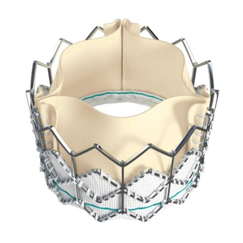 The Melody Transcatheter Pulmonary Valve Medtronic Minneapolis Minn