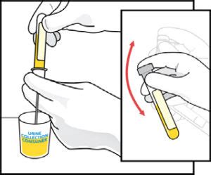 Urine Specimen Collection Instructions Cleveland Clinic Laboratories