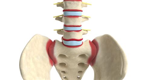 App Enthesitis Wirbelsäule MedicalGraphics