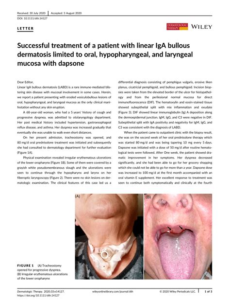 Successful treatment of a patient with linear IgA bullous dermatosis limited to oral ...