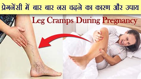 प्रेगनेंसी में नस चढ़ने का कारण और उपाय Pregnancy Me Nas Chadna Leg Cramps During Pregnancy