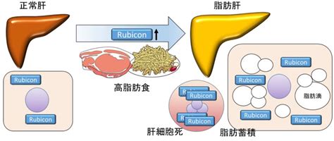 脂肪肝の発症メカニズムを解明 リソウ