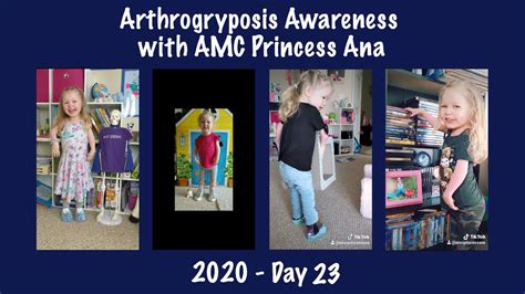 2020 Arthrogryposis Awareness With Amc Princess Ana Day 23 Youtube