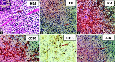 A Microscopy Of Stomach Spleen Pancreas Perigastric D1 And D2