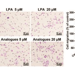 effect  lpa  lpa analogue  viability proliferation