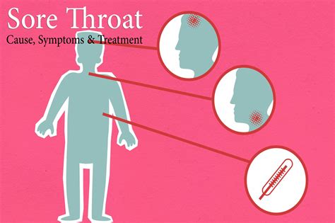 Sore Throat Cause Treatment And Symptoms Best Piles Bawaseer