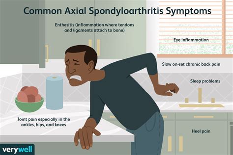 Axial Spondyloarthritis: Symptoms and Complications