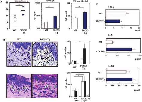 Forced Expression Of Socs On T Cell Enhanced Incidents In Ac A Socs