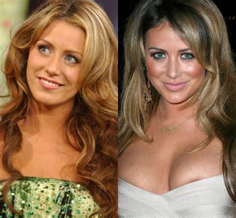 Aubrey O'Day Plastic Surgery: What has she done to her face?