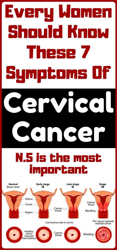 Cervical Cancer Symptoms Warning Signs