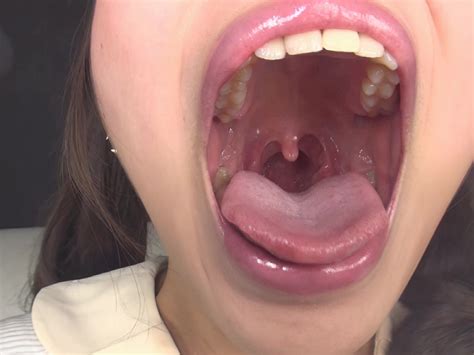 Japanese Girl Perfect Uvula