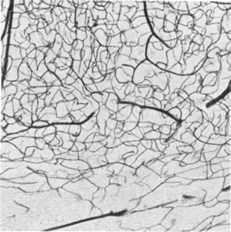 Fig. A.23. The vessels of the lower cortical layers at the wall of a... | Download Scientific ...