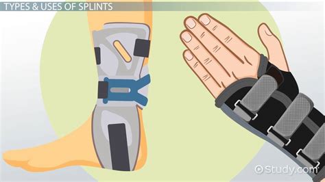 Splints in Occupational Therapy: Types & Uses - Lesson | Study.com