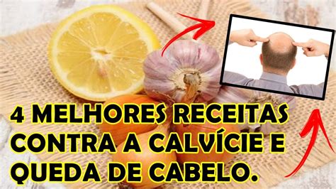 4 MELHORES RECEITAS CASEIRAS CONTRA CALVÍCIE E QUEDA DE CABELO YouTube