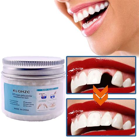 【fast Filling】diy Tooth Repair Kit Teeth Filling Solid Glue Temporary