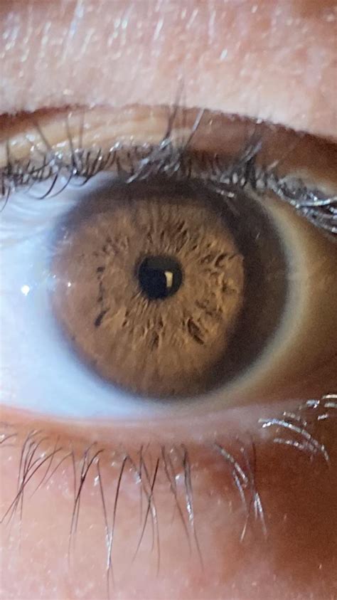 Can Anyone Read My Eye Curious On My Health Riridology