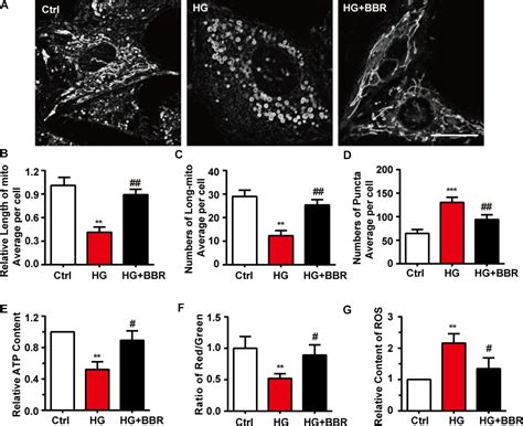 Frontiers Berberine Ameliorates High Glucose Induced Cardiomyocyte