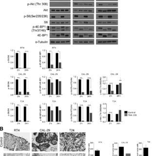 Molecular Effects Of TAK 228 On The PI3K MTOR Signaling Pathway A