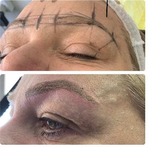 Album Semi Permanent Eyebrow Natural Enhanced Beauty Clinic Leeds