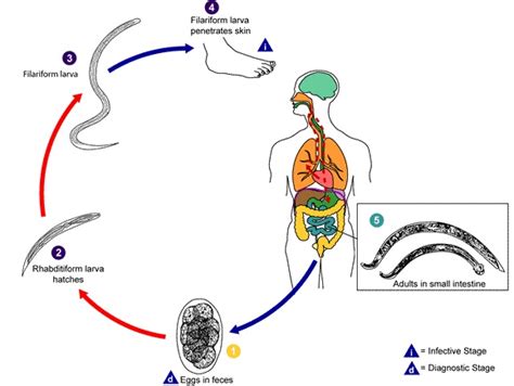 Ancylostoma O Uncinariasis Fundación Io