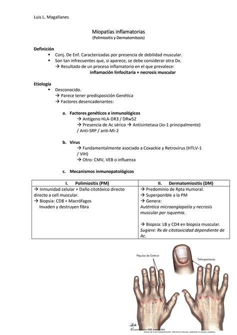 Solution Miopatias Inflamatorias Resumen Studypool