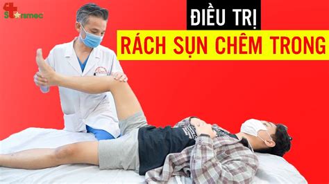 Rách Sụn Chêm Trong Đi ều Trị Và Chăm Sóc Thế Nào Bác Sĩ Thể Thao Nguyễn Trọng Thuỷ Youtube