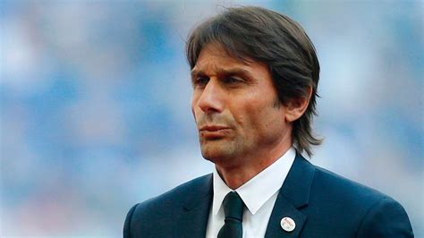 Analysing Antonio Conte's Hair Transplant