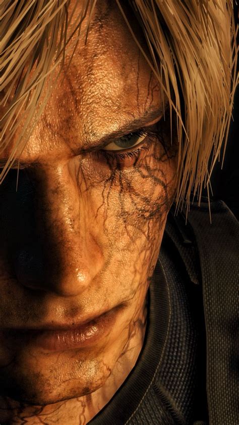 Infected Leon Kennedy Resident Evil 4 Remake