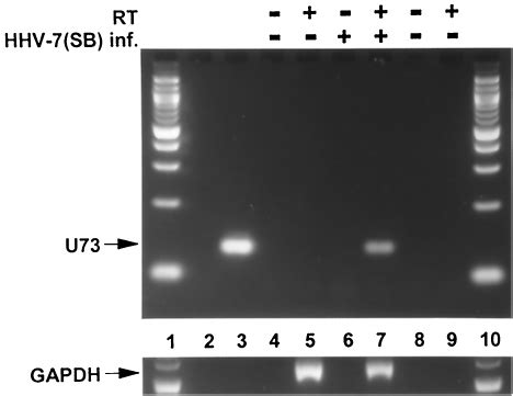 Rt Pcr Detection Of Hhv Sb U Obp H Tran Scripts Lanes And