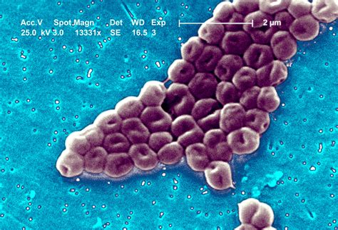 Las 9 Bacterias Y Hongos Que Hoy Amenazan A La Salud Mundial Y Dan Volumen A La Resistencia