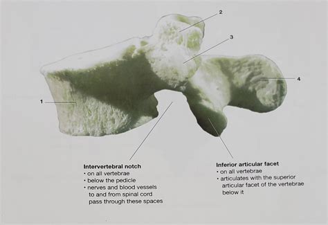 Lumbar Vertebra Lateral View Diagram Quizlet