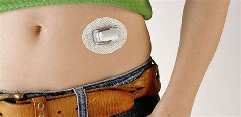 Real Time Cgm Dexcom Integriert Das Ambulante Glukose Profil Agp In