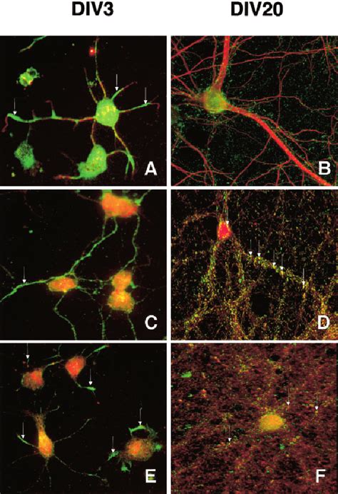 Maturation Related Targeting Of Synuclein To Different Neuronal