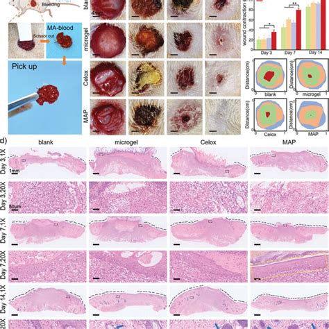 Wound healing performance of MAP: a) hemostasis of bacterial‐infected ...