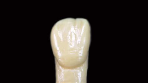 Live Wax Up Upper Lateral Incisor P Youtube