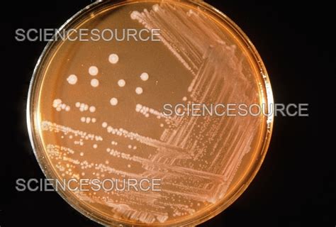 Salmonella Typhi Culture