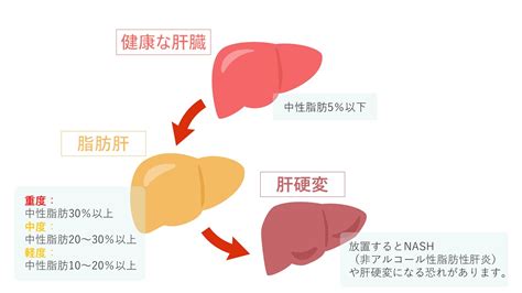 脂肪肝・nashと診断されたら尾張旭市城前町の尾張旭にいのみ内科消化器クリニックへ