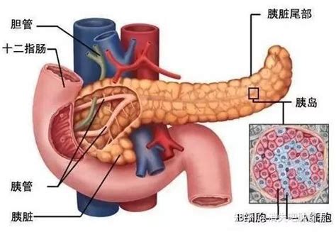 胰腺癌早期症状是什么？疼痛位置在哪里？ 知乎