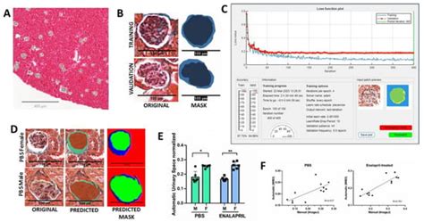 IJMS Free Full Text Sex Differences In Glomerular Lesions In Atherosclerosis Progression