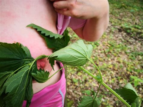 Brennnesseln On Tits 20 Pics XHamster