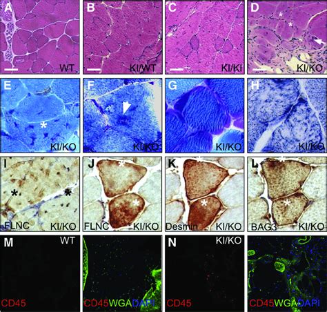 Histologic Analysis Of Gastrocnemius Muscles Of 4 Montheold Mice