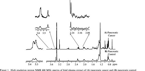 Shows The Aliphatic Region Of Representative Nmr Spectra Of The