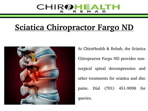 Ppt Sciatica Chiropractor Fargo Nd Powerpoint Presentation Free