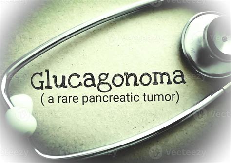 Glucagonoma, a rare pancreatic tumor. diagnosis medical concept ...