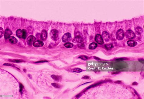 Stratified Columnar Epithelial Tissue