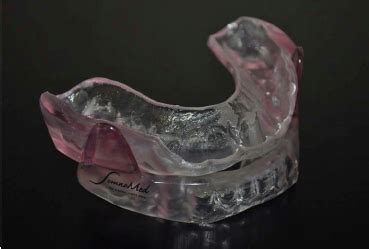 Mandibular Advancement Splint MAS Example Of A Customized Two Piece