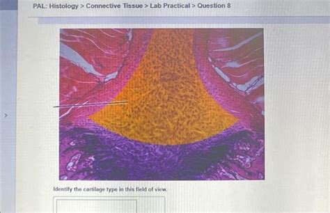 Solved Pal Histology Connective Tissue Lab Practical Chegg