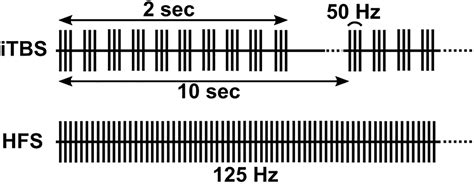 Frontiers Subcortical Intermittent Theta Burst Stimulation Itbs