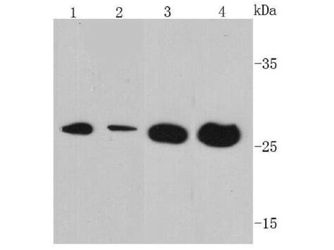 Vegf Polyclonal Antibody Pa5 141103